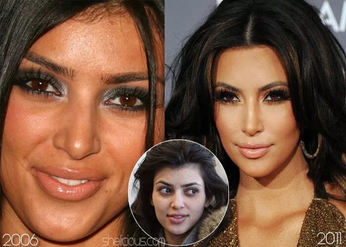 Кардашьян до пластики и после фото Kim-Kardashian-before-nose-surgery-chemical-peels-botox Kardashian plastic surge