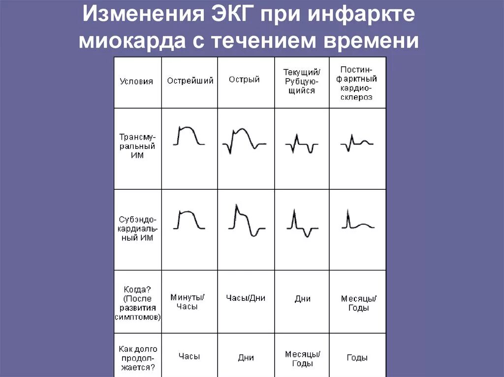 Кардиограмма сердца при инфаркте фото Los Santos Hospital Authority Basic life support and advanced life support - Арх