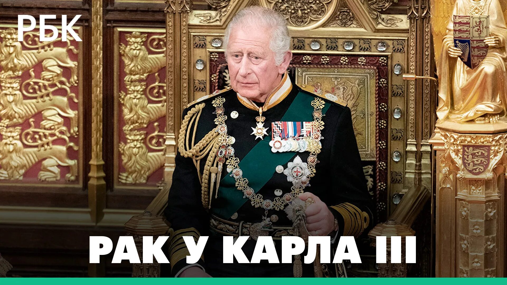 Карл 2 фото Диагноз британского монарха Карла III - смотреть видео онлайн от "РБК" в хорошем