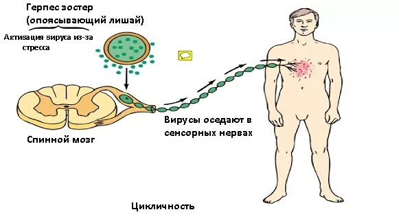 Картинки как выглядит опоясывающий лишай Опоясывающий лишай симптомы фото - ViktoriaFoto.ru