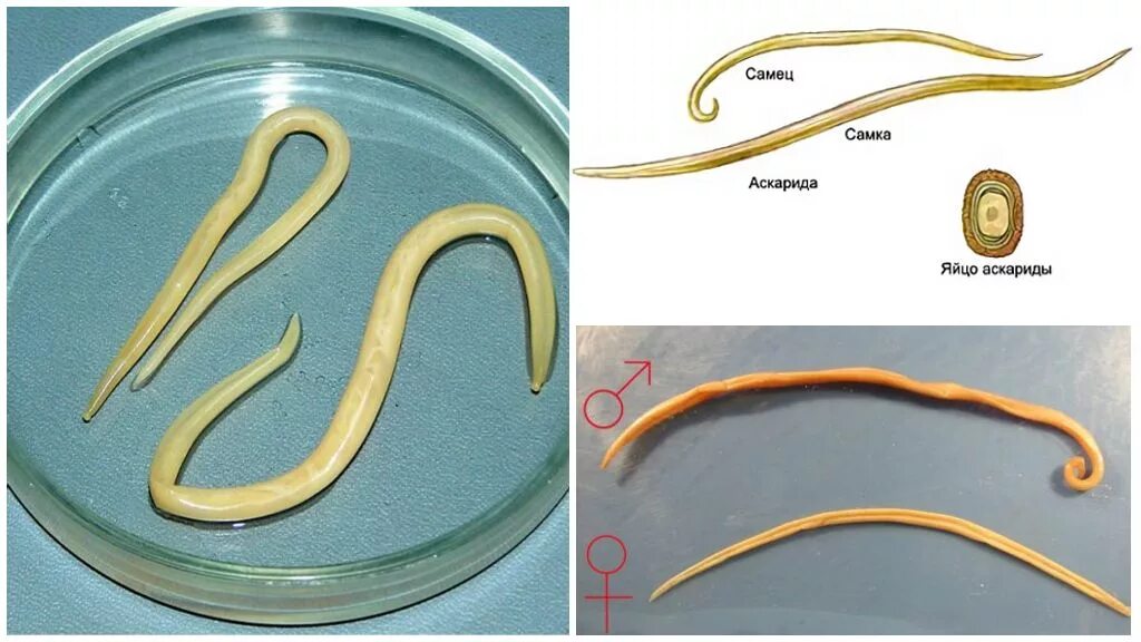 Картинки как выглядят глисты Самые большие глисты у человека