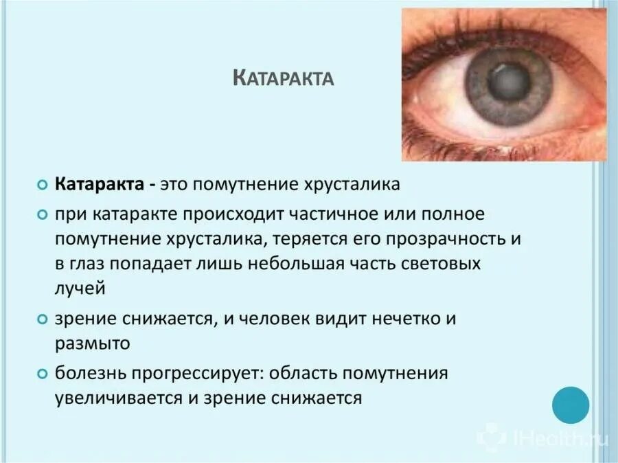 Катаракта симптомы фото Вторичная катаракта: причины, симптомы и лечение в статье офтальмолога орлова о.