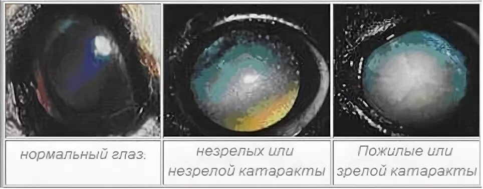 Катаракта у собак фото начальная стадия КАТАРАКТА - Болезни хрусталика у собак