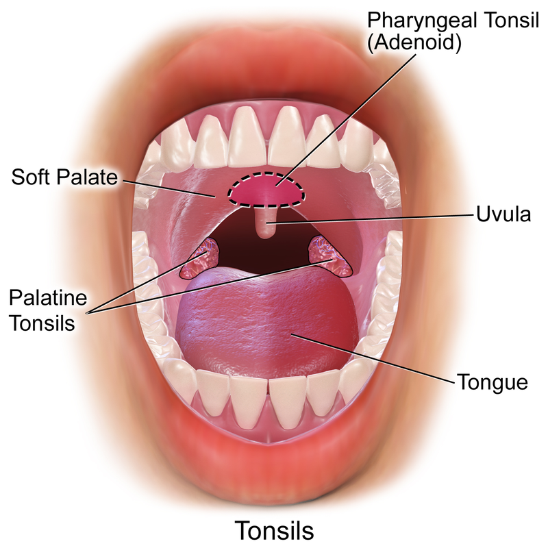 Катаральная ангина фото горла File:Blausen 0859 Tonsils&Adenoids.png - Wikipedia