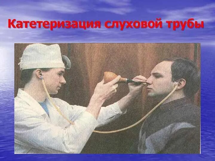 Катетеризация слуховой трубы фото Лекция 5 Заболевания наружного уха тубоотит острый