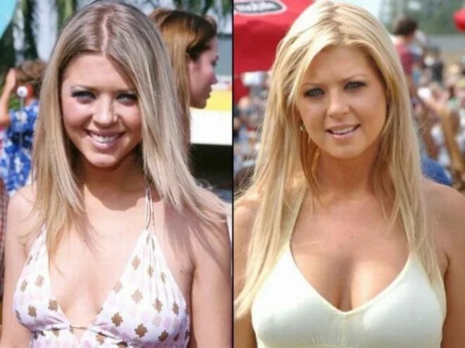 Катя самбука до пластики и после фото Tara Reid Celebrity surgery, Plastic surgery, Celebrities before and after