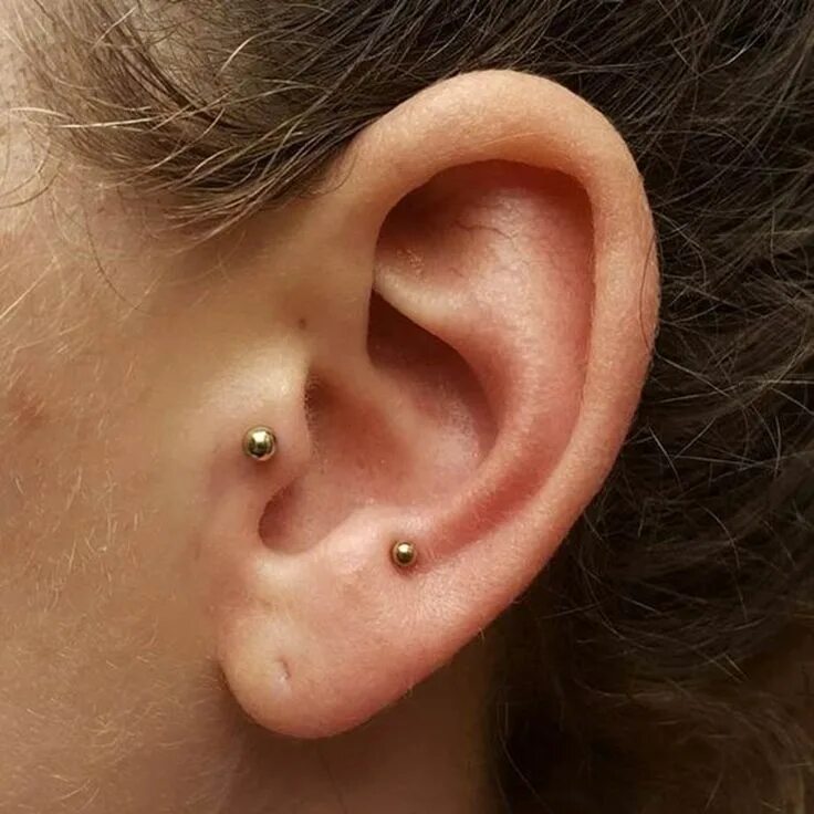 Келоид на ухе фото It's Time To Consider An Anti-Tragus Piercing Cool ear piercings, Piercings, Tra