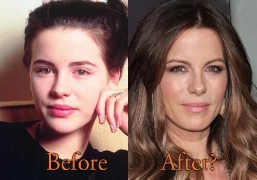 Кейт бекинсейл фото без макияжа и фотошопа Kate Beckinsale Plastic Surgery Before and After Photos. #katebeckinsale #cosmet