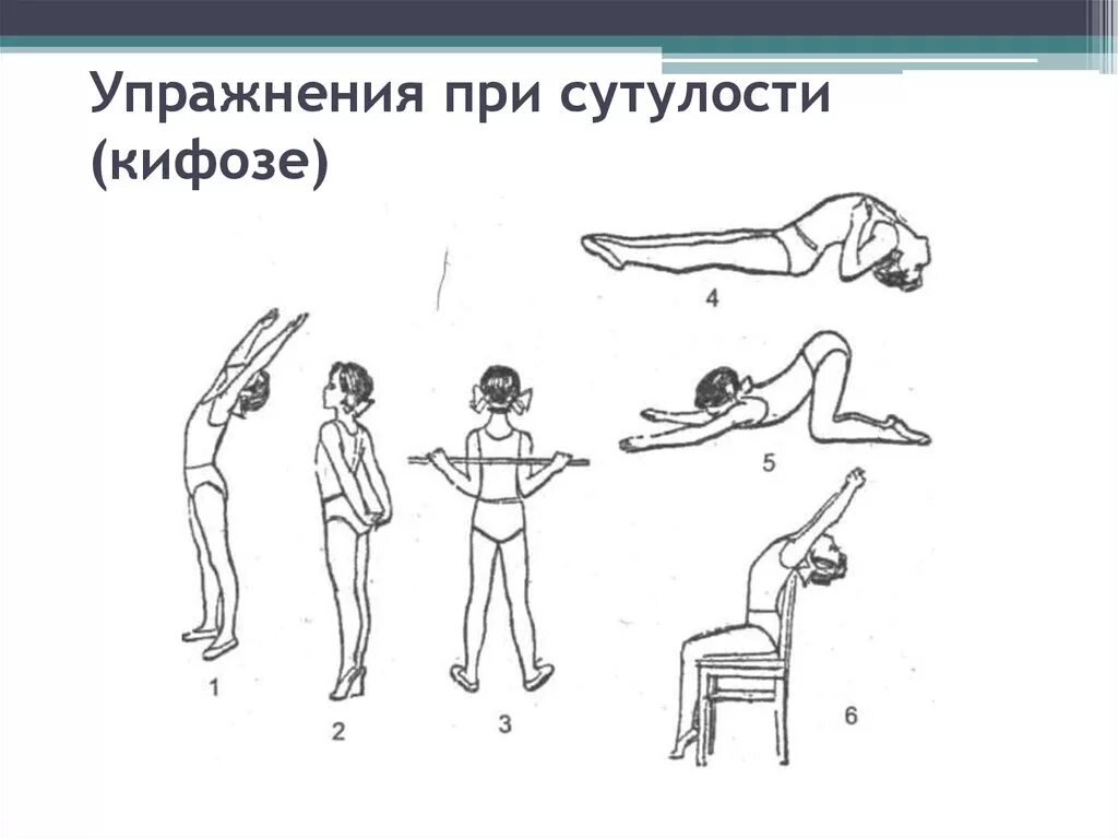 Кифоз поясничного отдела упражнения фото 3 Упражнения (гимнастика) при кифозе - польза и вред комплекса ЛФК spravki1.ru