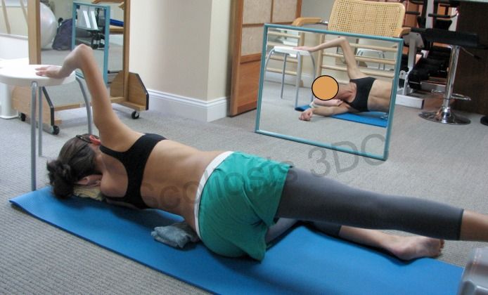 Кифоз поясничного отдела упражнения фото Schroth Method Scoliosis exercises, Scoliosis, Yoga for scoliosis