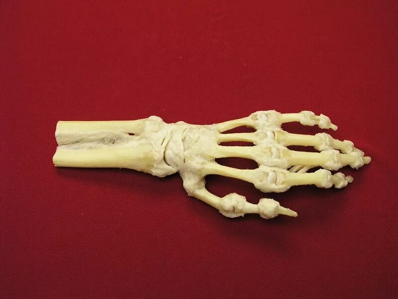 Кисть руки фото кости SUE-5 Radiocarpal, distal radioulnar, midcarpal joints and all palmar joints