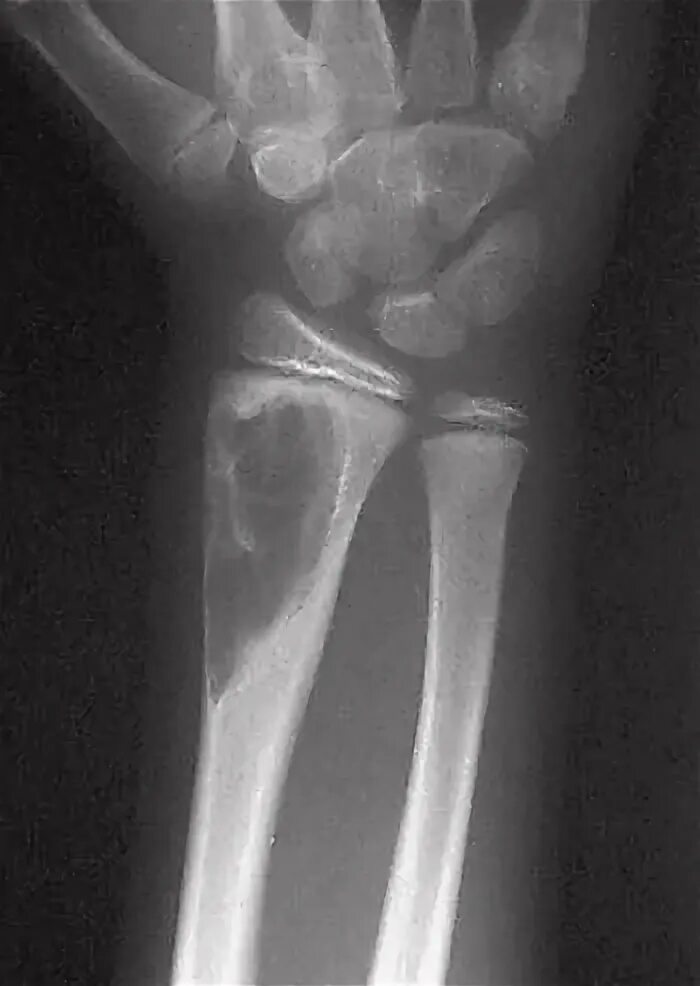 Киста кости фото Pin by Kathy I on Radiology Radiology technologist, Radiography, Radiology