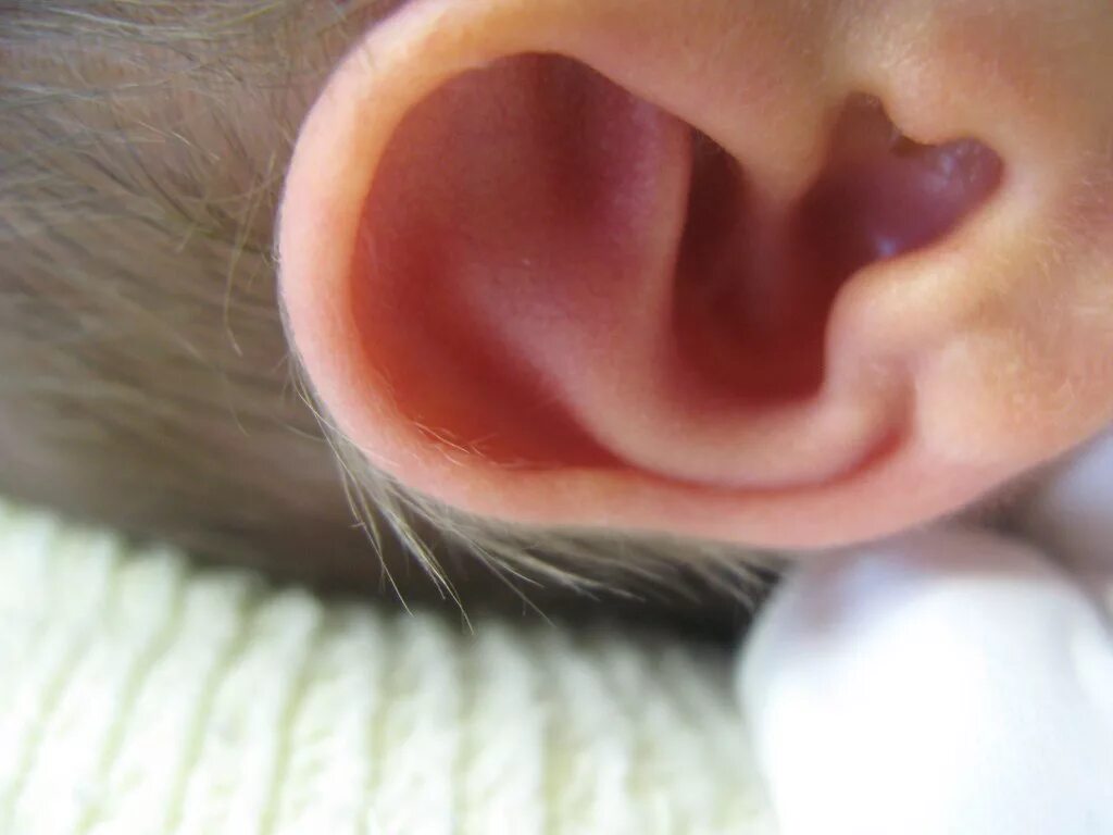 Киста на ухе у ребенка фото Newborn Ear My son has cute hairy hobbit ears rumpleteaser Flickr