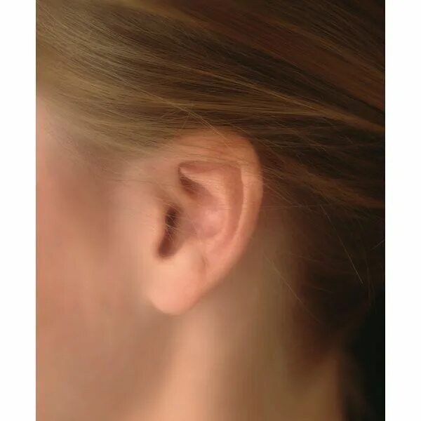 Киста на ухе у ребенка фото The primary step in treating ringing in the ears is discovering what might be cr