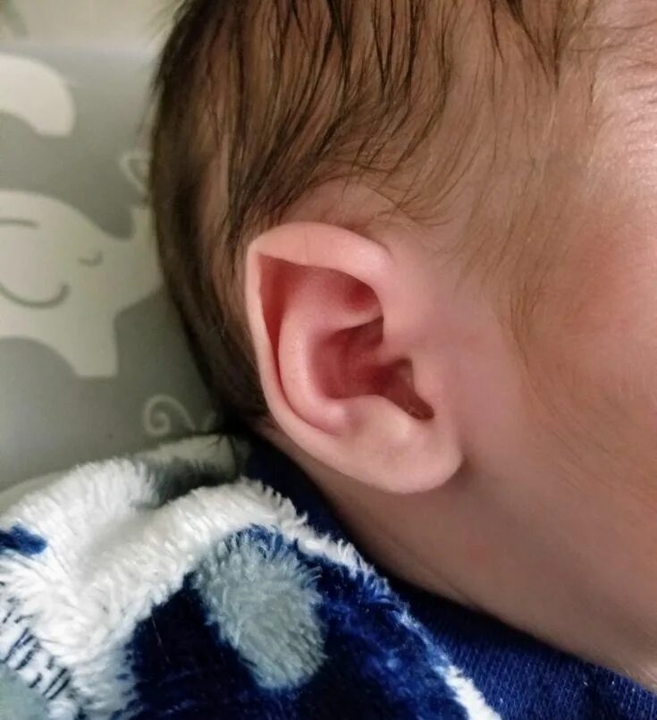 Киста на ухе у ребенка фото Pin em reborning