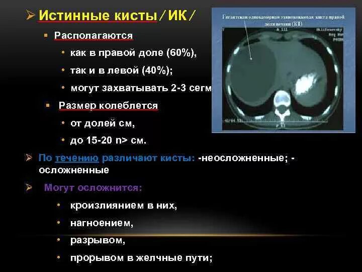 Киста симптомы фото Киста размером 5 см: найдено 85 изображений