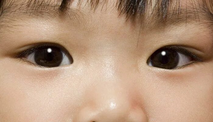 Китайские глаза фото Checks for eye problems start in the newborn nursery. Here are common childhood 