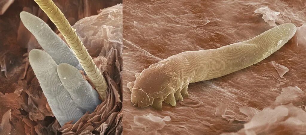 Клещ демодекс на голове фото Uno zoo di Demodex per tutti! - Microbiologia Italia