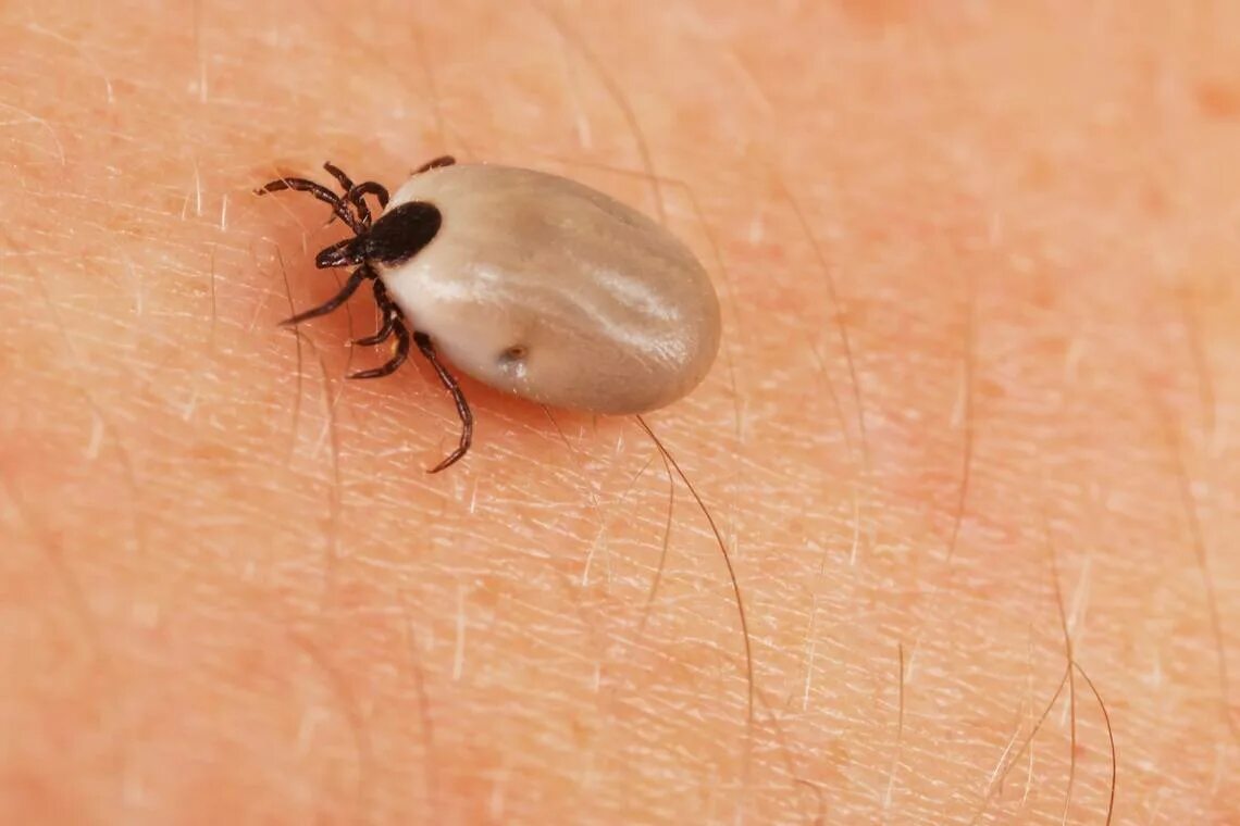 Клещ фото крупным планом в коже Are ticks a threat to people in Texas? Here’s what experts say are diseases to w