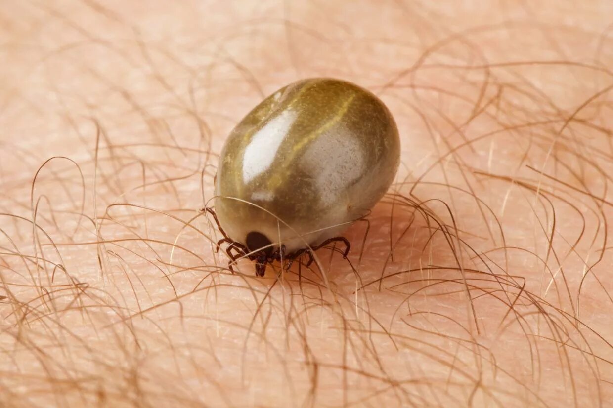 Клещ фото живота Tick-borne encephalitis (TBE) nidirect