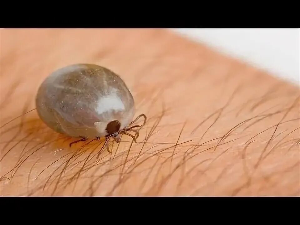 Клещ глаза фото 10 Incredibly Dangerous #Parasites Listerine, Picaduras de insectos, Picaduras d