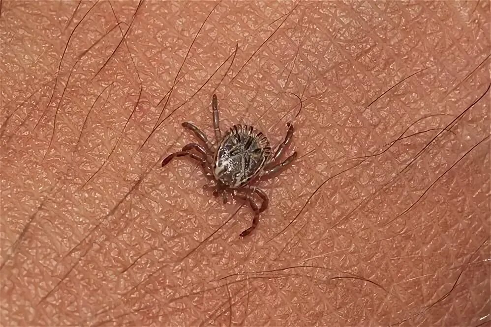 Клещ инфоцолидный как выглядит фото Amblyomma cajennense (Ixodidae) on my leg - male IVO Caura. Flickr