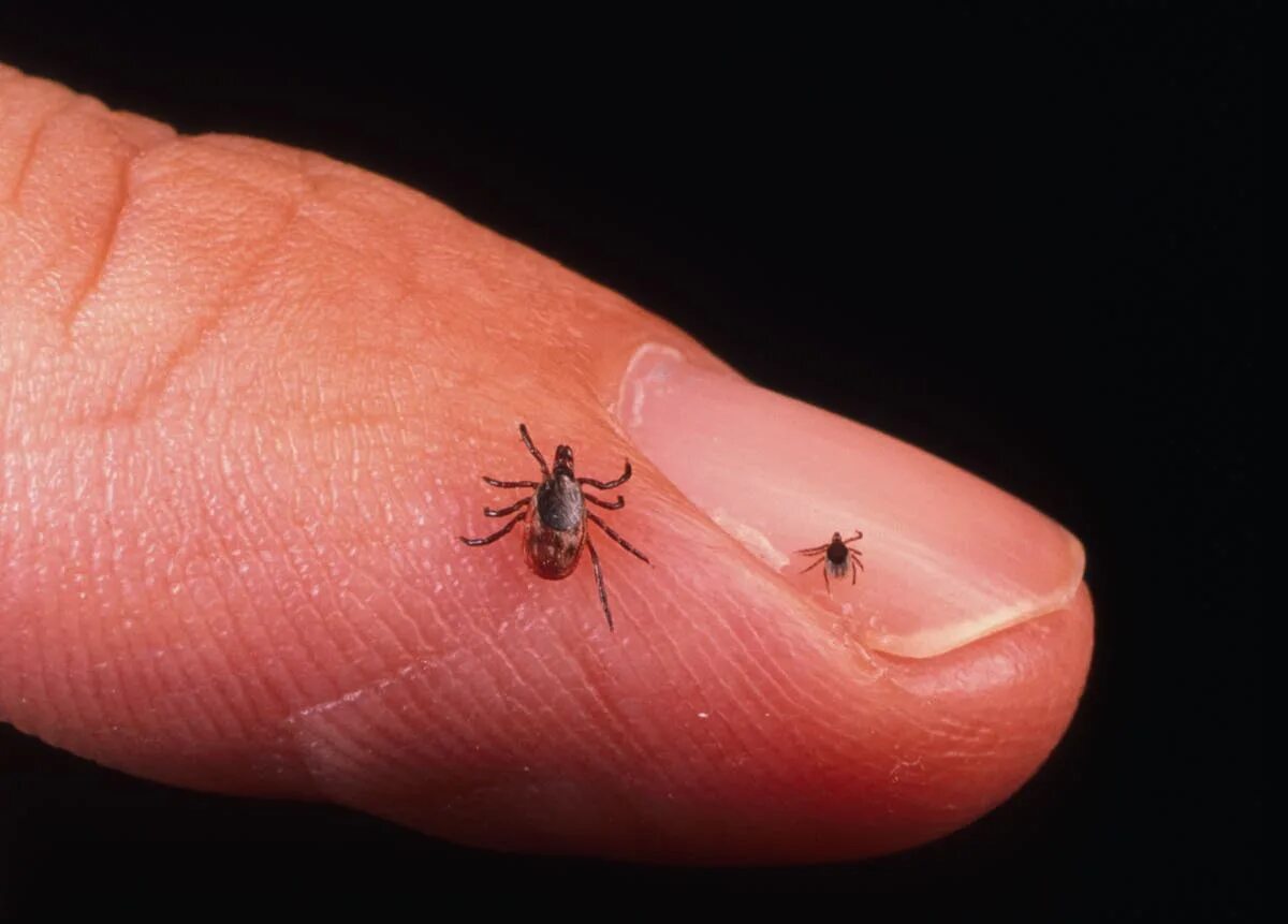 Клещ инфоцолидный как выглядит фото Alpha-gal syndrome: Tick bite leaves dog walker unable to leave his home The Ind