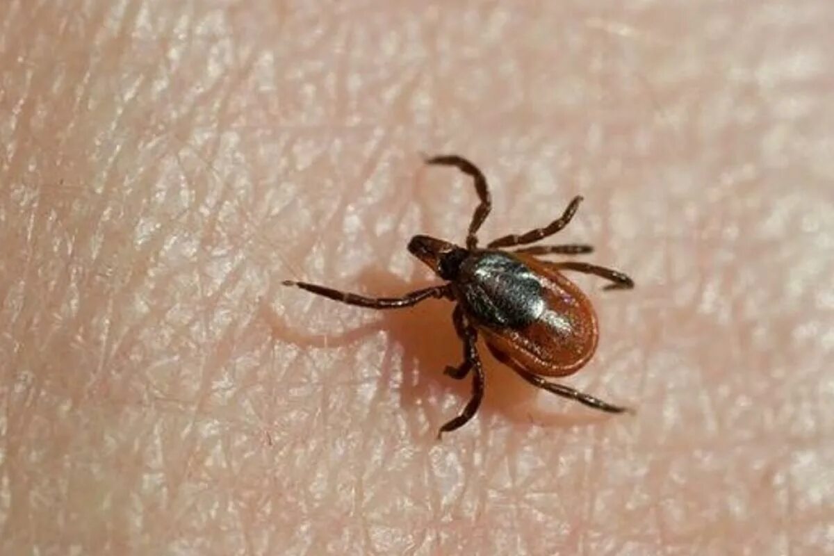 Клещ как выглядит фото крупным Medical Microbiology and Infectious Diseases (MSc) Explore UM University of Mani