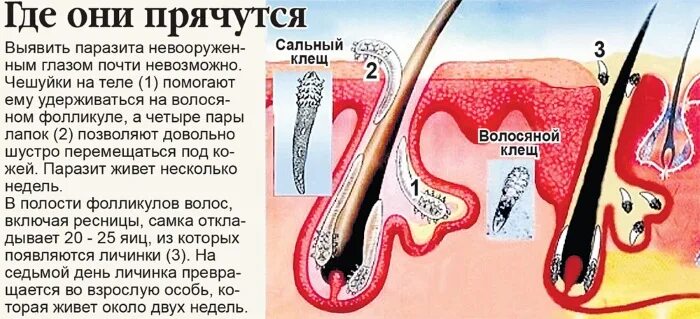 Клещ на лице лечение фото Демодекоз на лице у человека. Схема лечения, препараты, народные средства