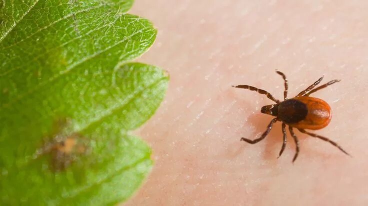 Клещ на спине фото Pin on Babesia blogs