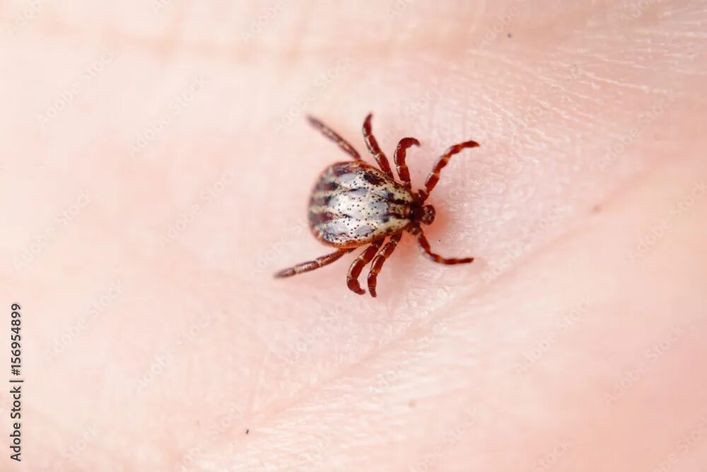 Клещ полосатый фото Forest mite on the skin. wood tick фотография Stock Adobe Stock