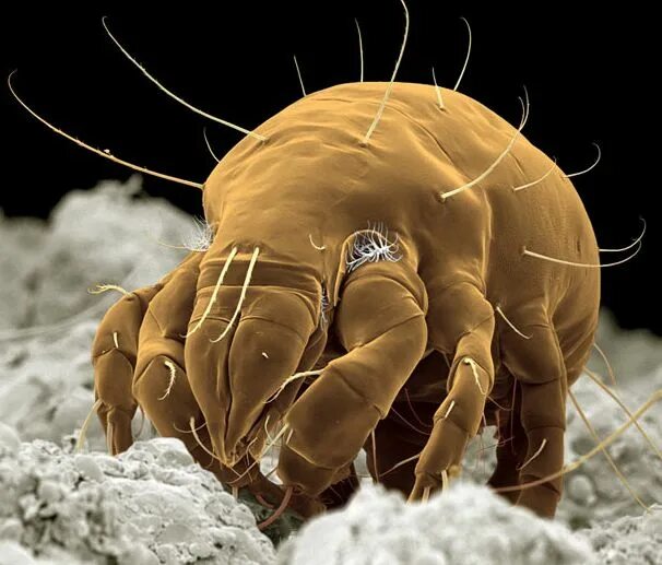 Клещ пылевой постельный фото Des insectes au microscope électronique Electron microscope, Insect photography,