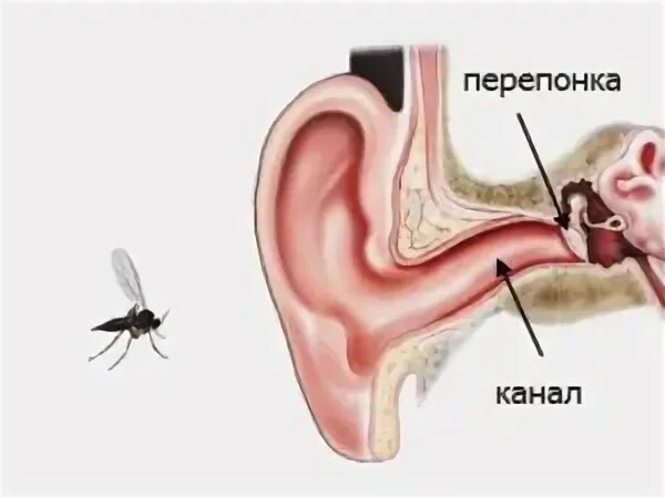 Клещ в ухе у человека фото Уховертка: стоит ли искать ее в ухе? - ЗвероСити