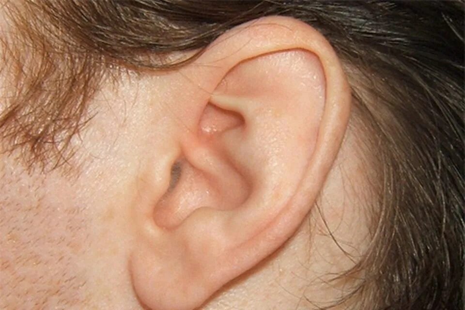 Клещ в ухе у человека фото Tiny device that heralds the end of unsightly hearing aids Irish Independent