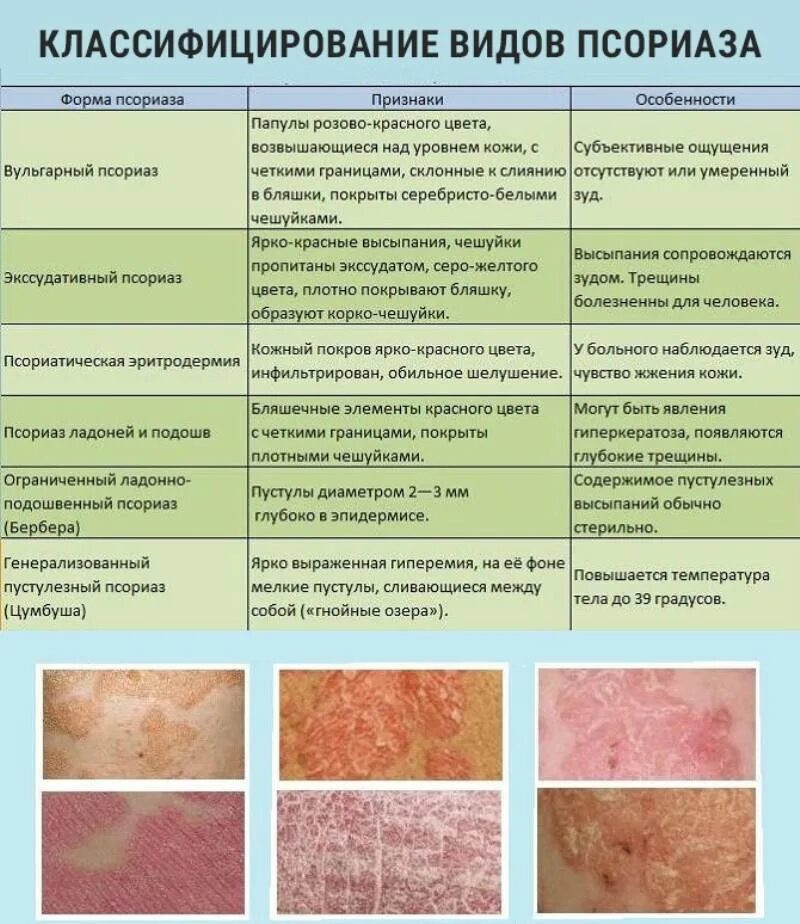 Клещевой дерматит фото Симптомы заболеваний кожи