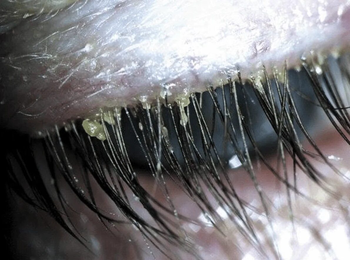 Клещи на ресницах человека фото Your Beautifully Mascaraed Lashes Are Probably Infested With Mites - FamilyToday