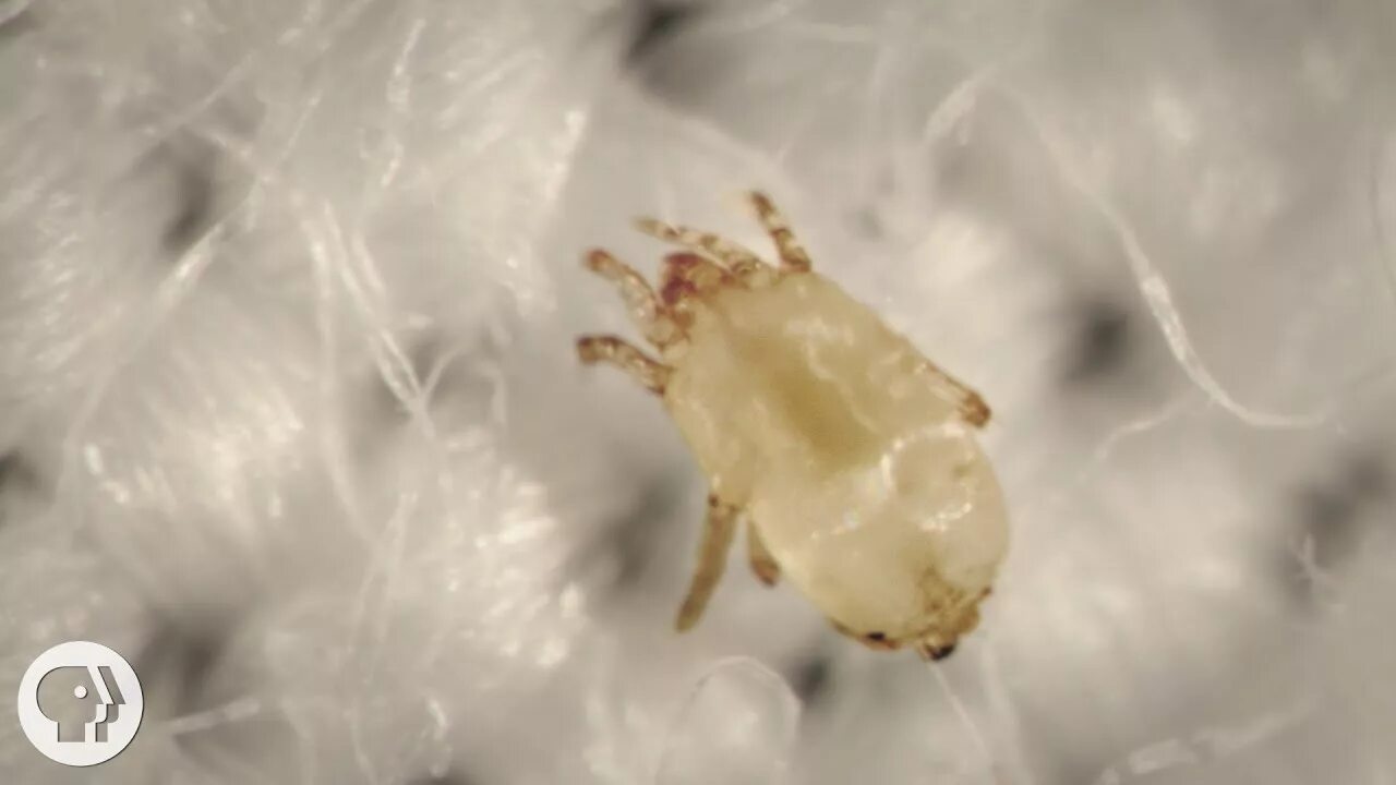 Клещи постельные фото в подушке Meet the Dust Mites, Tiny Roommates That Feast On Your Skin Deep Look - YouTube
