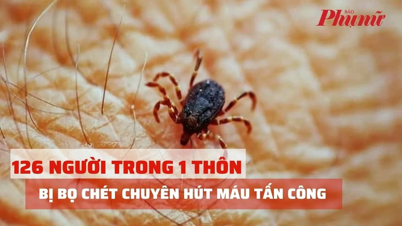 Клещи в квартире фото 126 người trong 1 thôn bị bọ chét chuyên hút máu tấn công Báo Phụ Nữ - YouTube