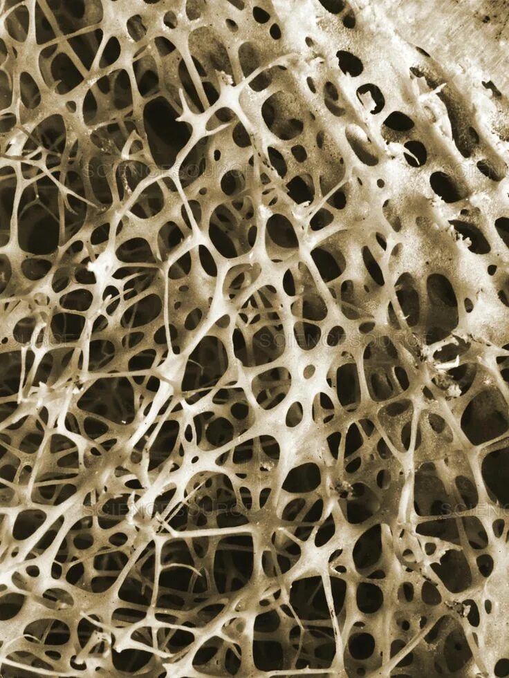 Клетки кости фото Image result for bone coral Microscopic photography, Natural structures, Pattern