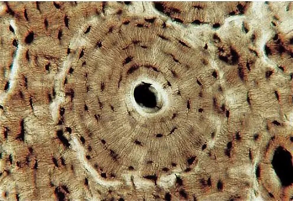 Клетки кости фото Last week's anatomic structure was a microscopic view of an osteon. The osteon (