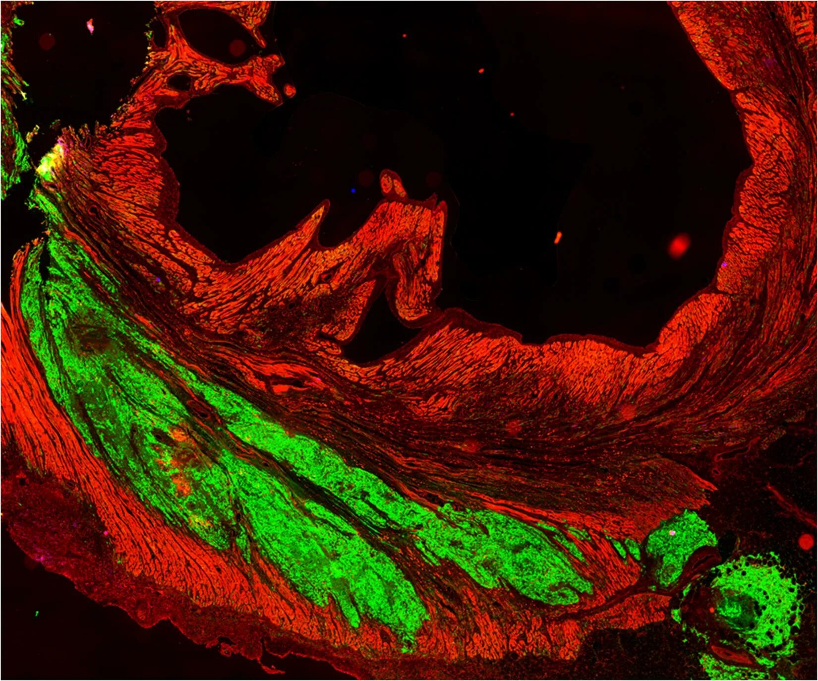 Клетки сердца фото Stem Cell Therapy Rebuilds Heart Muscle in Primates National Institutes of Healt