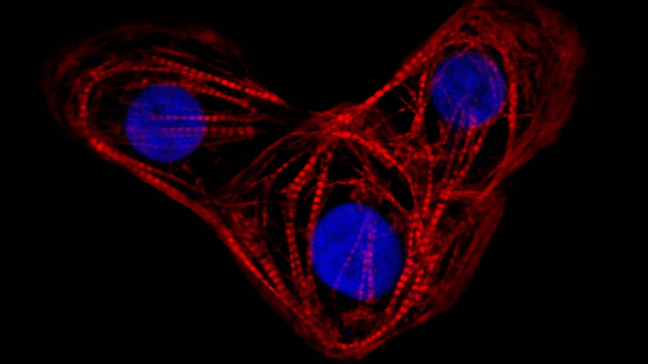 Клетки сердца фото True Love: How Transcription Factors Interact to Create a Heart Gladstone Instit
