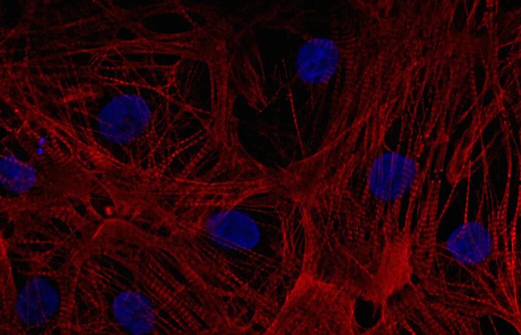 Клетки сердца фото Rescuing Heart Cells Following A Heart Attack Cardiology
