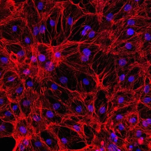 Клетки сердца фото Stream 538 by d34dh4nd Listen online for free on SoundCloud