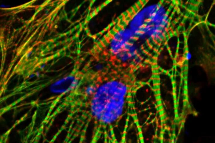 Клетки сердца фото Powerhouse proteins protect heart cells from EurekAlert!