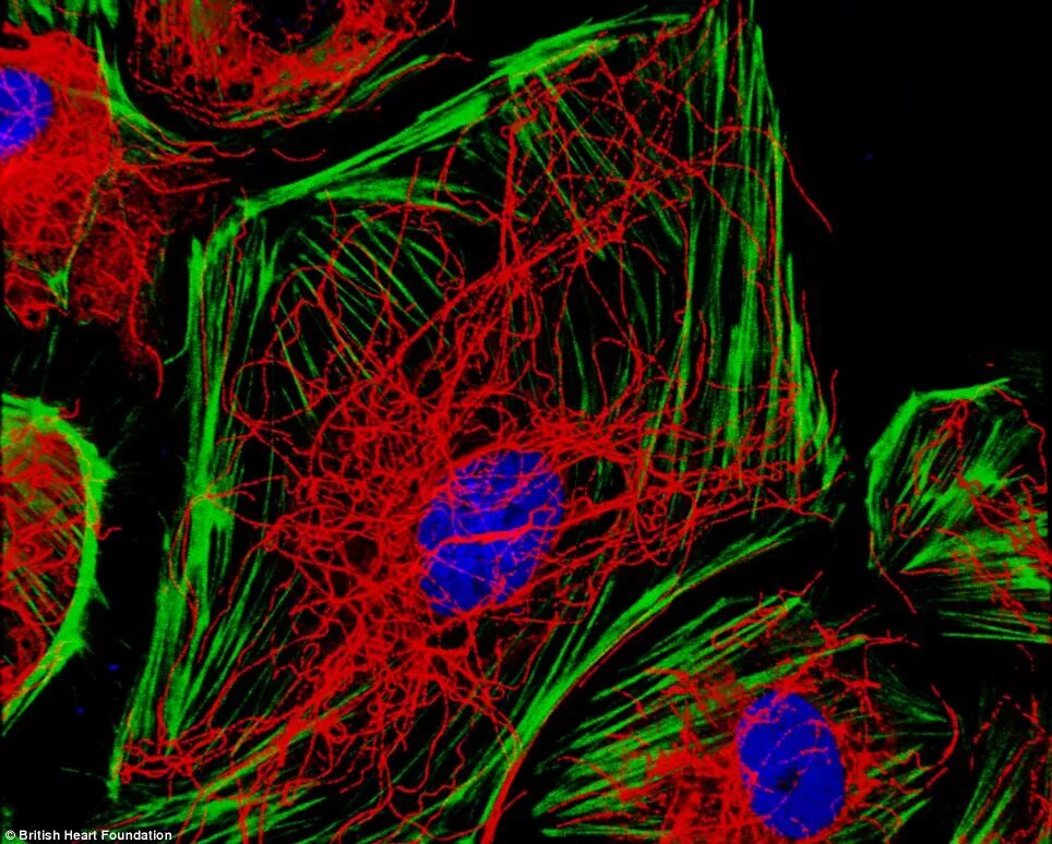 Клетки сердца фото From MRI scans to microphotography: Winning images from British Heart Foundation