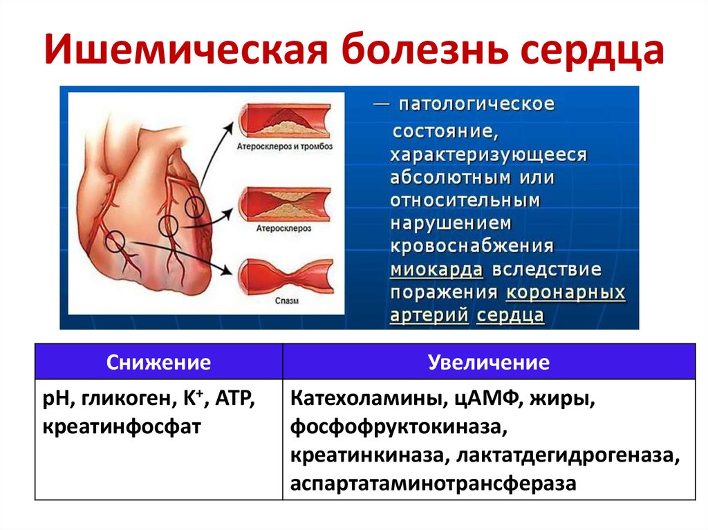 Клиническое фото Фотографии КЛИНИЧЕСКИЕ ПРОЯВЛЕНИЯ ИБС