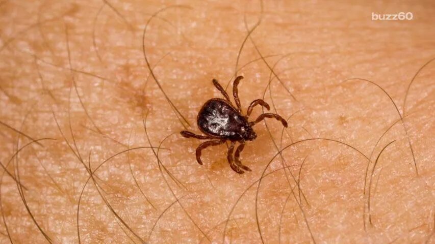 Клоп и клещ отличие фото Lyme Disease: What you need to know