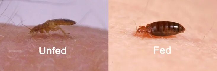 Клоп на теле фото Pin by forklifttrain on bed bug bites Bed bug bites, Bed bugs, Bed bugs infestat