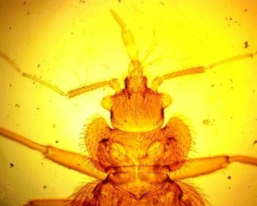 Клоп постельный под микроскопом фото Do bed bugs make noise? https://www.bedbugsinsider.com/do-bed-bugs-make-noise/ B